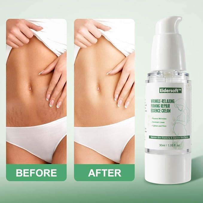 Wrinkle-Relaxing Firming Repair Essence Cream -