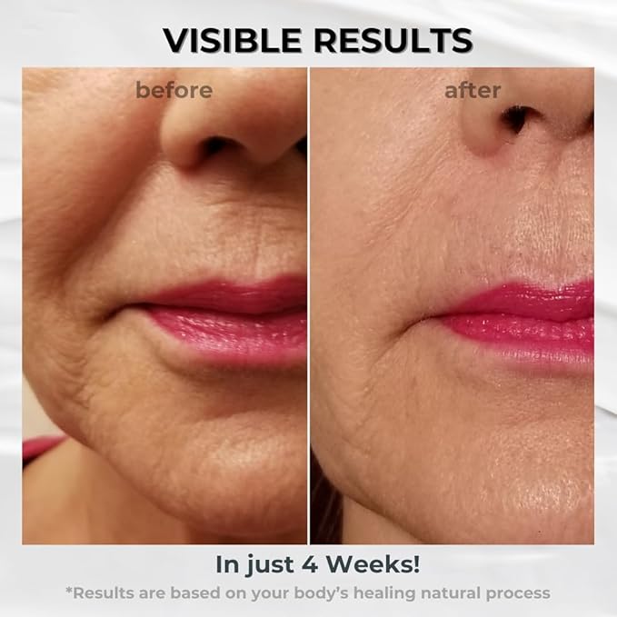 Anti-Aging Upper Lip Wrinkle Treatment 0.5oz.