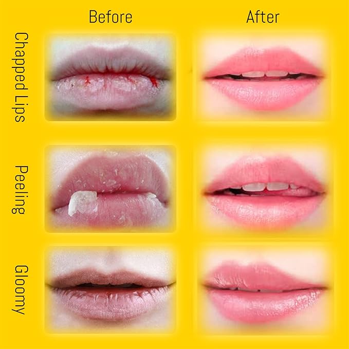 4PCS Lip Balm Honey Pot, Honey Sleeping