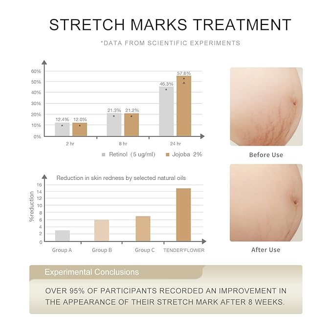 Stretch Mark Oil(110ml), body oil Care,Moisturizing