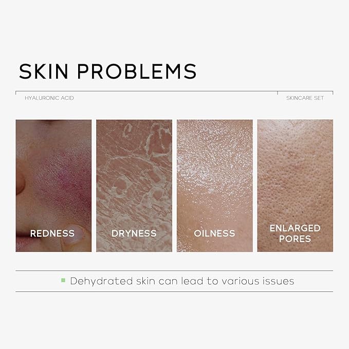 Hyaluronic Acid Skin Care Set, Hydration
