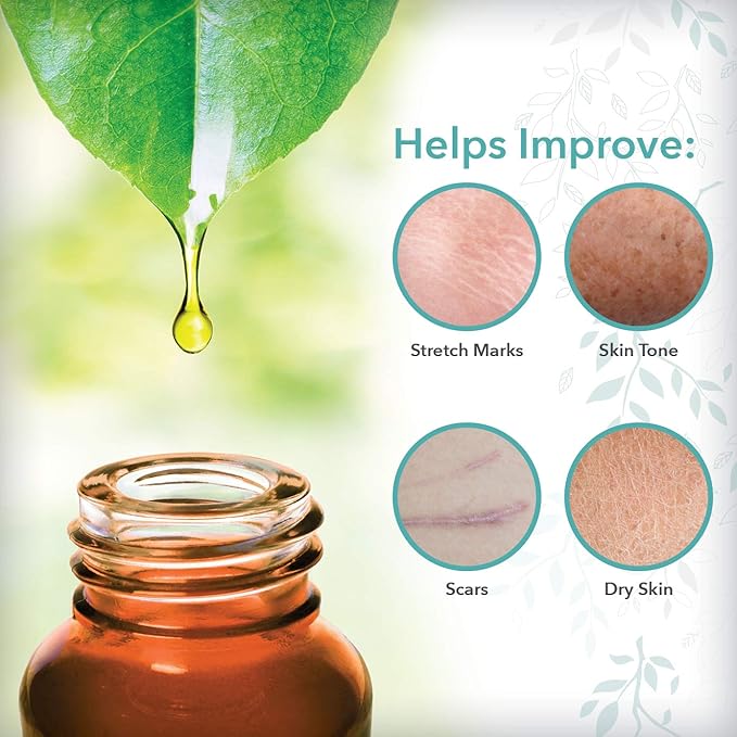 ReTone® Body Oil: Stretch Mark Prevention