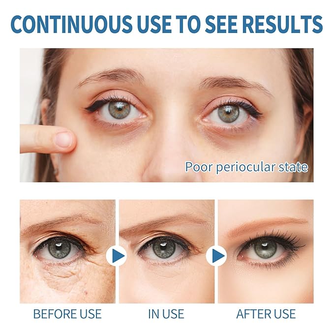 Anti-aging under eye patches strong