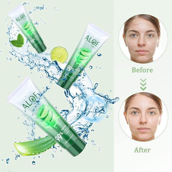 200x2 ML Aloe Vera Gel – 99% Organic Pure Aloe Vera Hydrating Face & Body Moisturizer, Natural Aloe Cream for Dry Skin, Sunburn, Acne, Soothing & Moisturizing