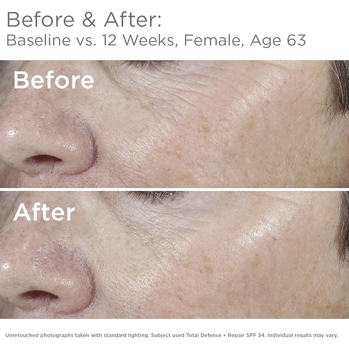 SkinMedica Total Defense + Repair SPF 34 Tinted Sunscreen for Face. This Lightweight, Facial Sunscreen is Ideal for Oily and/or Combination Skin, 2.3 Oz