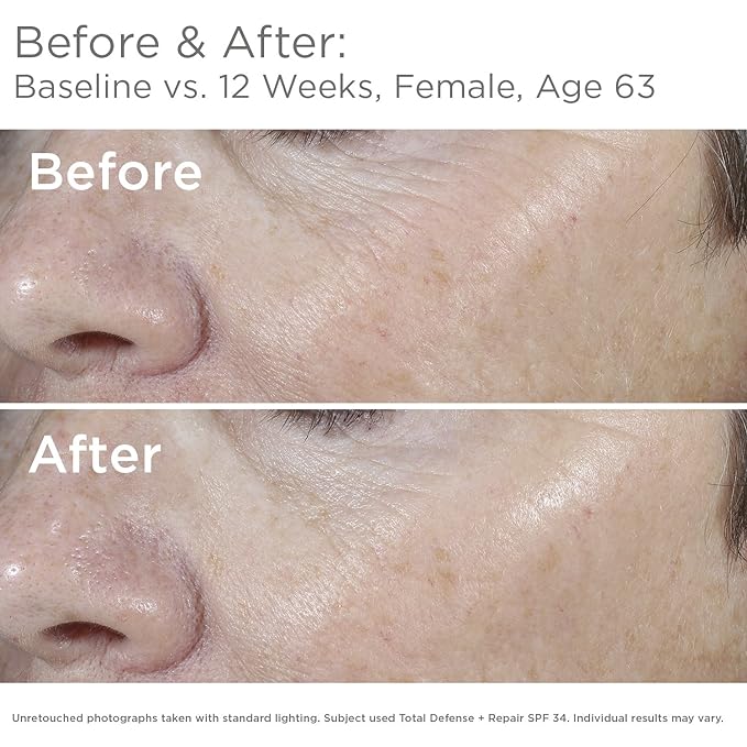 SkinMedica Total Defense + Repair SPF 34 Sunscreen for Face. This Lightweight, Facial Sunscreen is Ideal for Oily and/or Combination Skin, 2.3 Oz