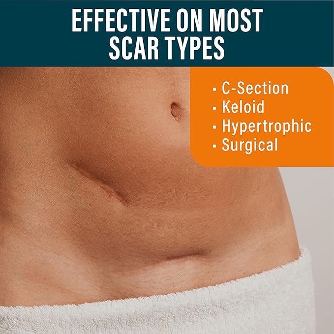 NUVADERMIS Silicone Scar Sheets ? Extra