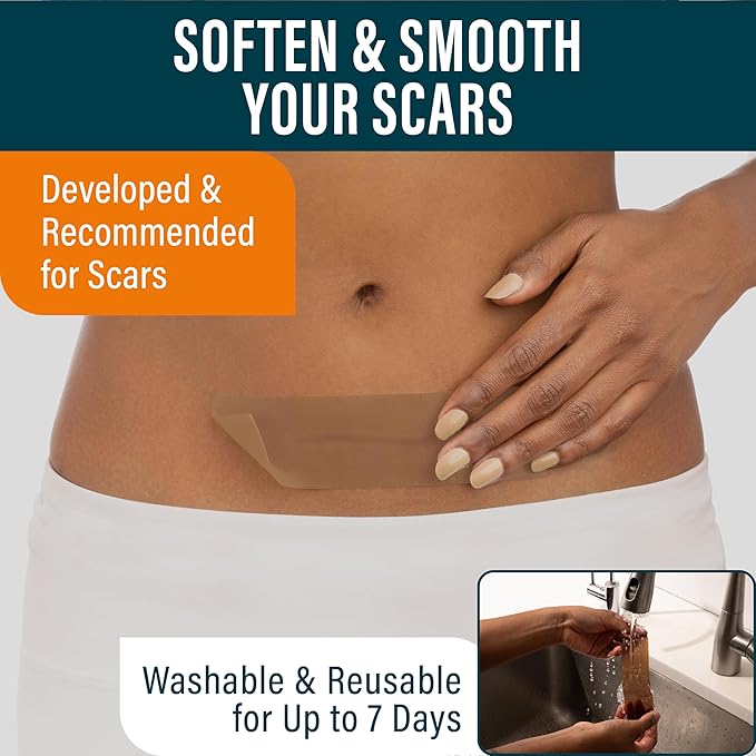NUVADERMIS Silicone Scar Sheets ? Extra