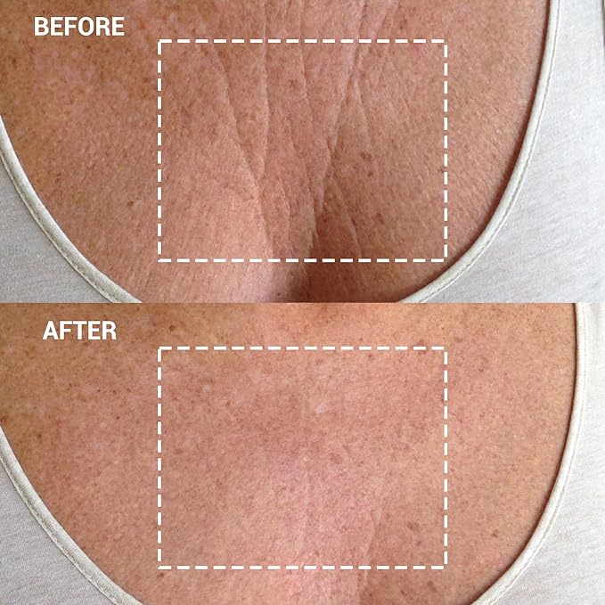 Wrinkles Schminkles Chest Wrinkle Patch - Smoothing