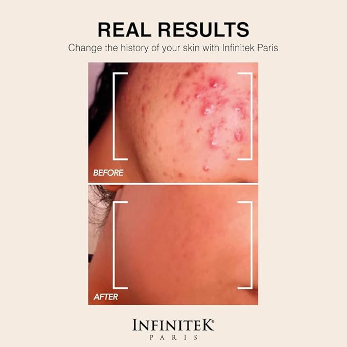 Infinitek Paris Retinol Face Moisturizer Night Cream - Premium Skin Care with Collagen & Vitamin E. Advanced Anti-Aging and Antioxidant Face Cream. Skin Vitamin Enriched Moisturizer for Radiant Skin