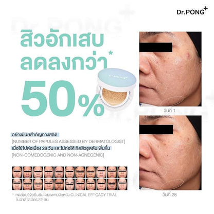 Dr.PONG ACNE ACE Longwear Cushion (Light, 15) 15g