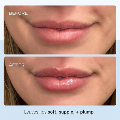 First Aid Beauty - Ultra Repair Lip Balm, Instant Hydration and Moisture for Soft, Supple & Plump Lips, Concentrated Formula of Botanical Oils, Butters & Waxes, Cruelty Free, 0.25 oz