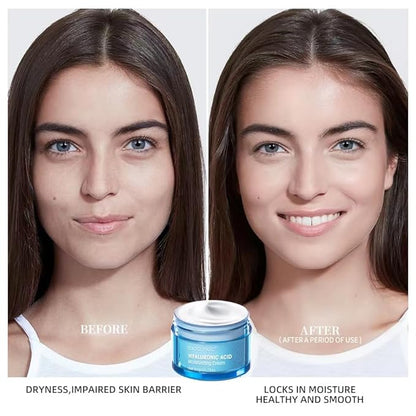 Hydro Boost Hyaluronic Acid Moisturizing Cream, Oil-Free, Suitable for Facial Moisturizers on Dry Skin ， Long Iasting Hydro Boost Moisturizing Cream-1.76Oz (white)