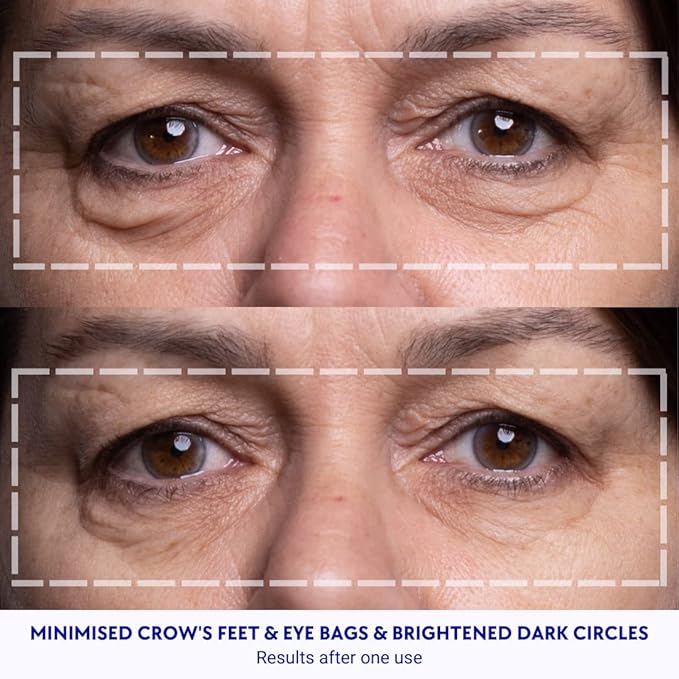 Wrinkles schminkles under eye wrinkle