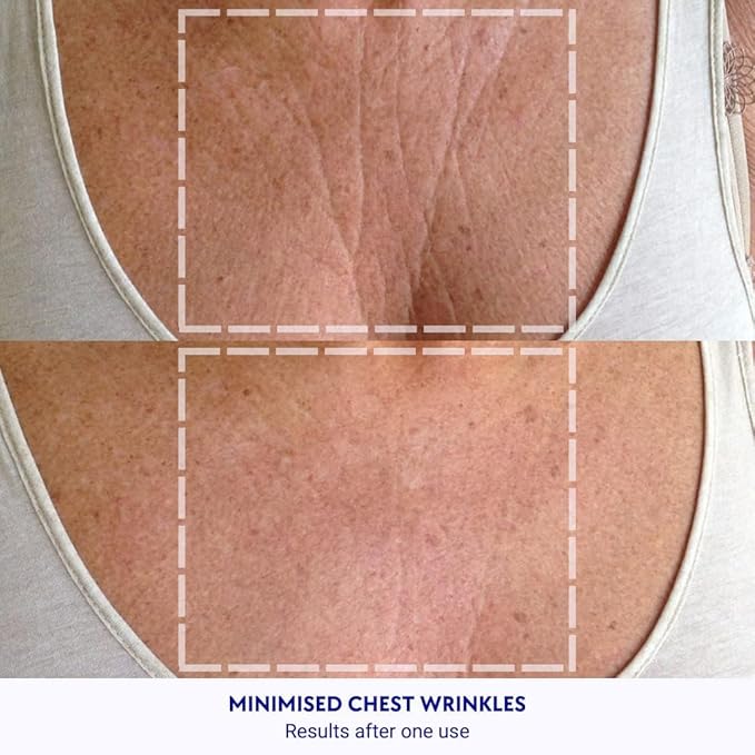 Wrinkles Schminkles Chest Wrinkle Patch &
