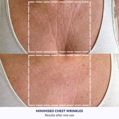 Wrinkles Schminkles Chest Wrinkle Patch &