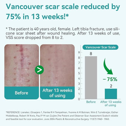 Dimora Professional Silicone Scar Sheets -