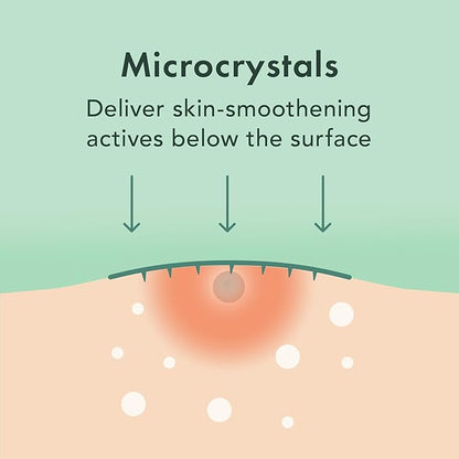 Rael Pimple Patches, Invisible & Microcrystal Spot Cover - Hydrocolloid Acne Patch for Face, Zit and Blemish, Breakouts, Vegan, Korean Skin Care (33 Count)