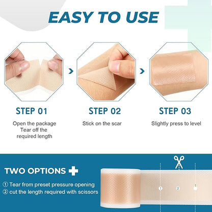 Silicone Scar Sheets, Silicone Scar Tape(1.6¡±x