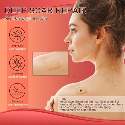 Silicone Scar Sheets (1.6¡±x 60¡± Roll-1.5M),