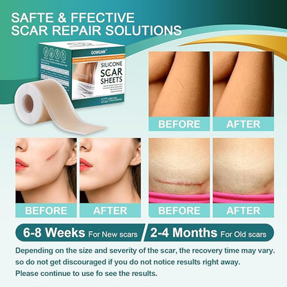 Medical Grade Silicone Scar Sheets, Silicone