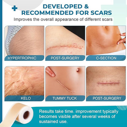 Silicone Scar Sheets, Silicone Scar Tape(1.6¡±x