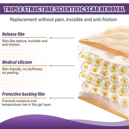 Silicone Scar Sheets,Silicone Scar Tape,Scar Tape