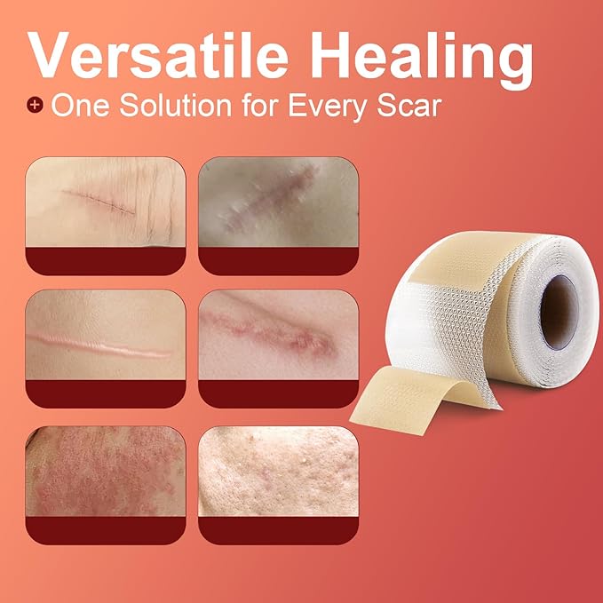 Silicone Scar Sheets (1.6¡±x 60¡± Roll-1.5M),