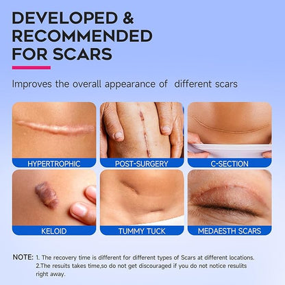 Thicker Silicone Scar Sheets, Medical Grade