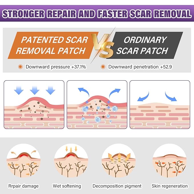 Silicone Scar Sheets,Silicone Scar Tape,Scar Tape