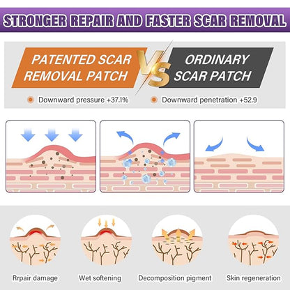 Silicone Scar Sheets,Silicone Scar Tape,Scar Tape