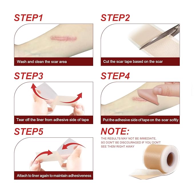Silicone Scar Sheets (1.6¡±x 60¡± Roll-1.5M),