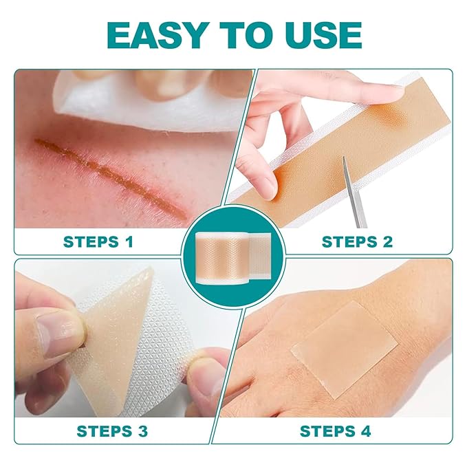 Extra Long Silicone Scar Sheets (1.6”