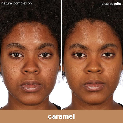 Almay Clear Complexion Acne Foundation Makeup with Salicylic fl oz.