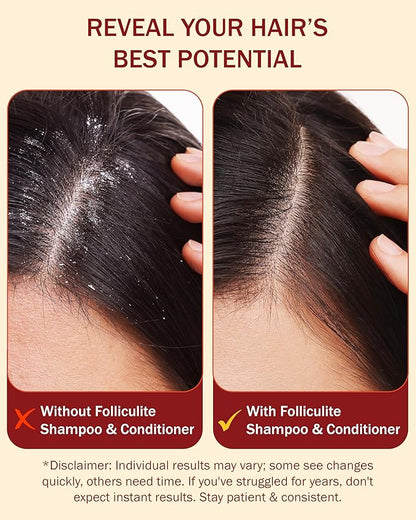 3% BHA Folliculitis Shampoo and Conditioner for Women & Men - Made with Salicylic Acid & Tea Tree Oil - Flakes Shampoo & Deep Conditioner for Dry Itchy Scalp & Acne by e70